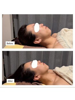 ピュット(pyt)/フェイスライン作るの得意です！