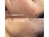 【リフトUP/シミケアに◎】顔プラズマ×頭皮プラズマで徹底改善70分