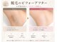 リノ 天神大名店(Lino)の写真/通いやすい価格で脱毛デビューにピッタリ!脱毛が初めての方も大歓迎!【初回全身脱毛4,000円】［天神］