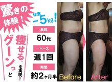 ポポの木サロン/ビフォーアフター