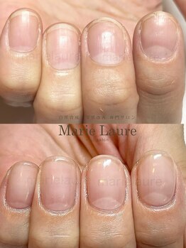 マリーロール 淀屋橋本店(Marie Laure)/自爪育成/深爪矯正/ネイルケア