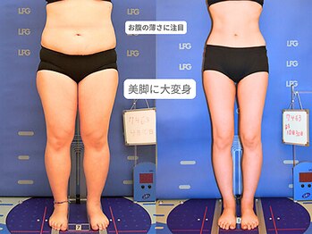 アンシャンテ 神戸元町店(Enchante)/痩身ダイエット　神戸元町三ノ宮