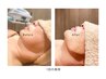NEW【話題のレモンボトル２cc】二重顎、小顔におすすめ　90分￥9,000