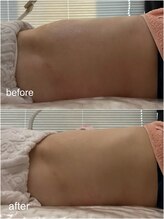 ミミ(MIMI)/お腹ペタンコ施術☆