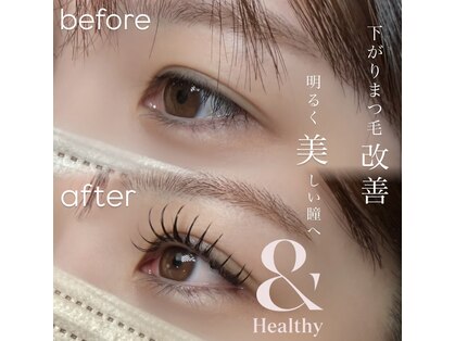 エルメ(elme)の写真