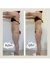 キラリス(Kilaris)/《ー10キロだって可能☆》