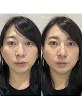 ブリューテ(Bluete)/透明感＆美人顔を叶える♪