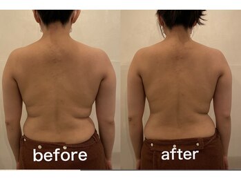 小顔堂 大阪心斎橋店/カラダのゆがみ ウエスト くびれ