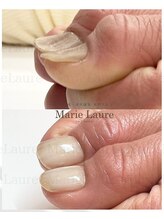 マリーロール 淀屋橋本店(Marie Laure)/自爪育成/深爪矯正/ネイルケア