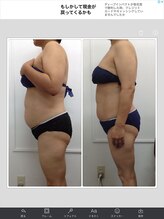 健康痩身研究所 蟹江店/ビフォーアフター