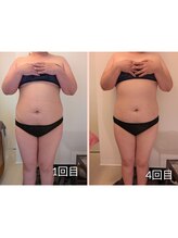 ワイズ(Y's)/お腹４回目