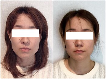 美容整体ウェリナ 名駅院/小顔矯正/骨盤矯正/美脚サロン