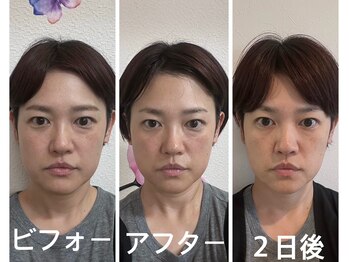 アクアナチュラ(ACQUANATURA)/むくみと左右差がスッキリ