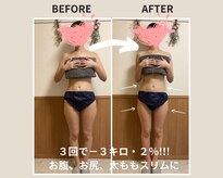 ヨサパーク ミラー(YOSAPARK Mirror)