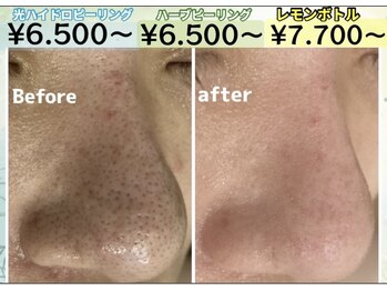 アリュール(ALLURE)