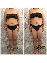 ラニ(LANI)/新型ハイパーナイフ6