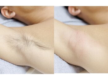 ブラジリアンワックス専門店 彩/ブラジリアンワックス専門店 彩