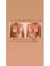 ウララカ(uraraka)/