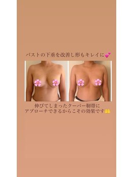 ウララカ(uraraka)/