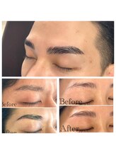 マンケイブ(MAN CAVE)/施術事例