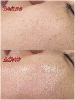 プチ プロムナード(Petit Promenade)/美肌フェイスワックス