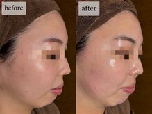 ヒナノ 矢場町店(HINANO)/クリスティーナアンストレス