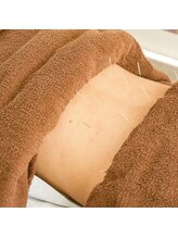 南行駅近整骨院/腰に効く鍼