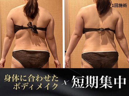 アクアリジェの写真