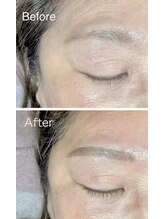 クリル(Kuril)/ビフォーアフター40代女性♪