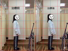 はばたき鍼灸整骨院/before/after