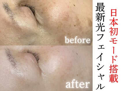 サンティエ(Santie)の写真