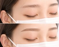 リーチェビューティアオ(riche Beauty Ao)