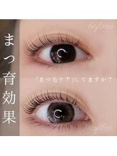 シルミエ(cilumie)/次世代ラッシュリフト