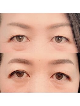 ラプチャー(Rapture)/美眉スタイリング♪