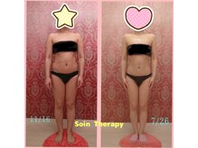 ソワンテラピー(Soin Therapy)/溜め込み体質から痩せ体質へ