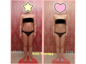 ソワンテラピー(Soin Therapy)/溜め込み体質から痩せ体質へ