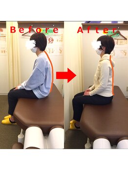 ゆかわ鍼灸整骨院/姿勢の変化