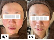 サロン サルー(SALON Salud)/◇再生美容