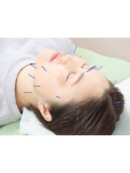 鍼灸施術を受けたい