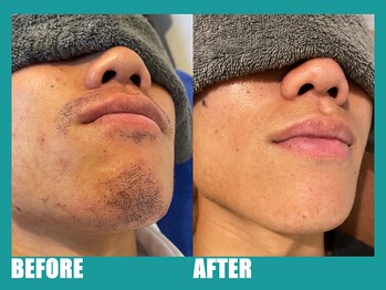 ピース 京都駅前店(piece)/【第一印象で全て決まる】