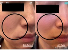 デザート(dessert)/ララピールbefore→after