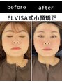 エレヴィザ トウキョウ 恵比寿院(ELVISA TOKYO) 姿勢改善整体/骨盤矯正/恵比寿/東京/渋谷/広尾/小顔矯正