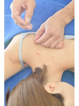 津山鍼灸整骨院/