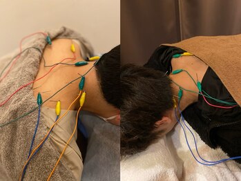 恵比寿駅前整骨院はり院 別館/肩コリ　腰痛　鍼