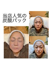 マックス(MAX)/炭酸パックビフォーアフター