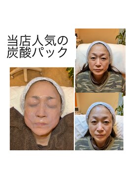 マックス(MAX)/炭酸パックビフォーアフター