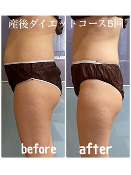 葡のか(ほのか)/産後ダイエットに努力はいらない