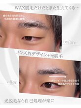 リノア(Linoa)/メンズ眉毛ビフォーアフター