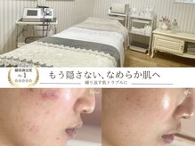 ソワンドビジュー(soin de bijew)