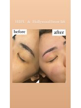 エールバイボヌール(Ere by Bonheur)/Hollywoodbrowlift+フェイシャル